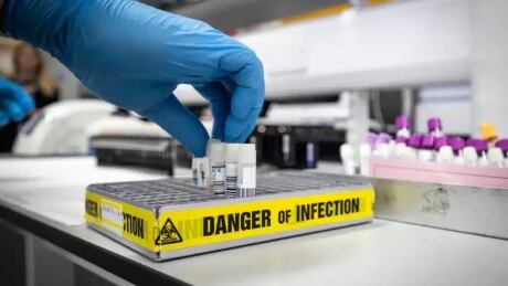 Manitoba has reported more than 58,700 cases of COVID-19 since the pandemic began. COVID test samples