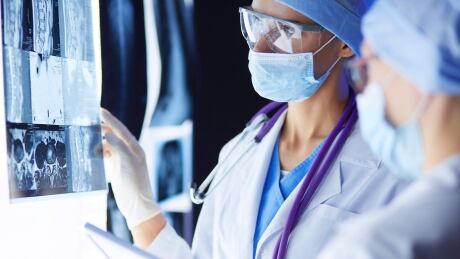 Two female women medical doctors looking at x-rays in a hospital.; Shutterstock ID 788812561; user: sheena.goodyear@cbc.ca; manager: Paul Gorbold ; email: 9661017; project: As It Happens 788812561