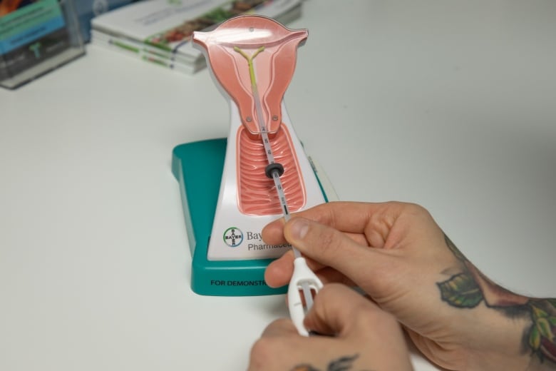 A person's hand is seen demonstrating how to insert an intrauterine device (IUD) into a uterus model.