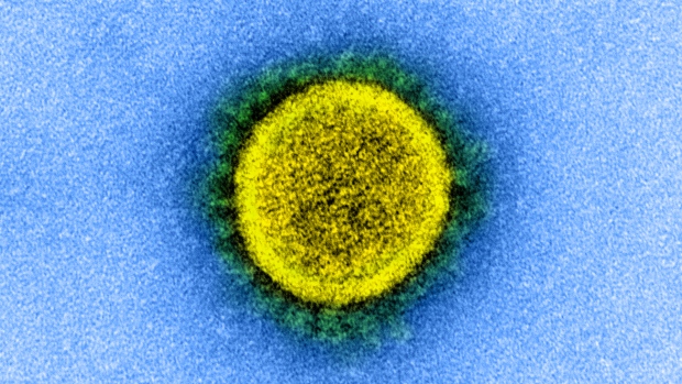 1st Canadian case of highly mutated COVID-19 virus variant BA.2.86 detected in B.C.; A transmission electron micrograph of SARS-CoV-2, isolated from a patient\. Scientists say this virus is capable of reinfecting humans again and again\. But just how often can it happen, and will it feel milder each time\?