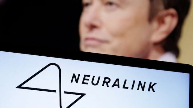 Elon Musk’s Neelink Brain Fin Fin is equipped with 2 quadriplegic patients Canadian as part of a clinical trial