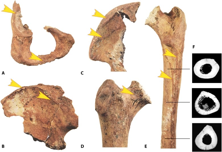 The image shows various points on the pelvis and thigh bones where changes occur with regularly horseback riding, as well as cross sections of the thigh bone.