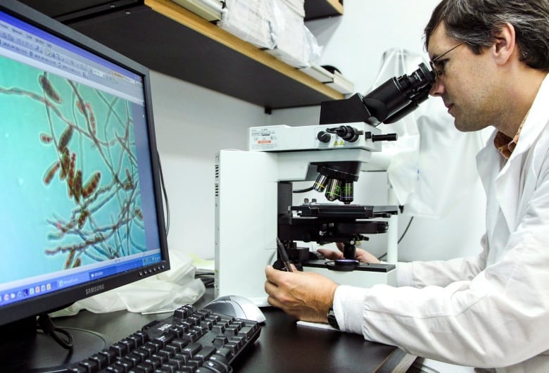 Man looking at a microscope with a projection of fungus on a screen beside him.