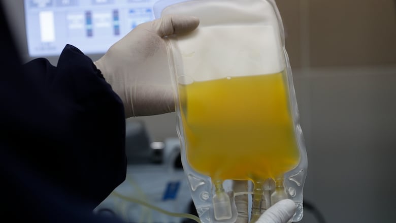 A bag of yellow liquid held by someone wearing gloves.