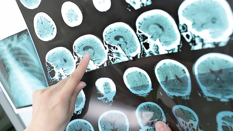 doctor view output CT scan