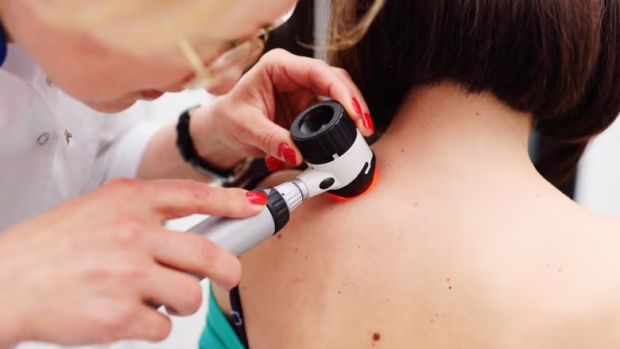 Why is it so hard to see a dermatologist in Quebec?; Several factors are causing the long wait-lists for the specialists\.