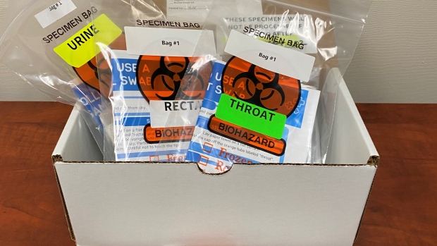 Nova Scotia launches take-home STI testing kit, a first in Atlantic Canada; A sexually transmitted infections \(STI\) test kit with a full screening package is shown on Aug\. 13, 2024\.