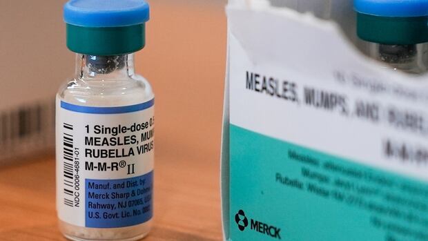 Alberta's measles case counts climb with central zone hardest hit