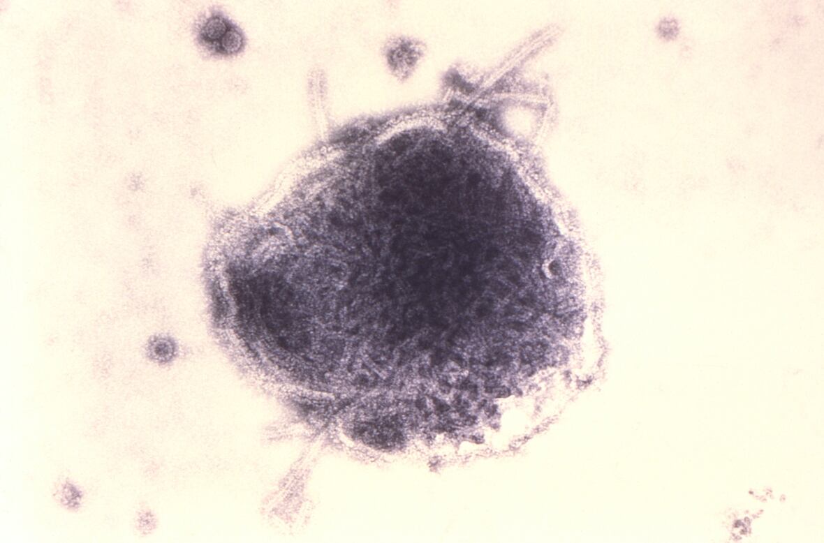 A digitally colourized transmission electron micrographic of the reveals immoderate   of the ultrastructural morphology exhibited by some  a paramyxovirus measles microorganism  (MeV), and virions of the polyomavirus, simian microorganism  SV40. 
