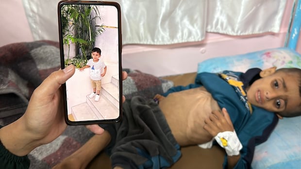 Children face starvation in Gaza as Israel's blockade of food, medication reaches 2 months