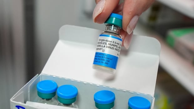 Measles outbreak and community exposure declared in Vaughan: health agency | CBC News