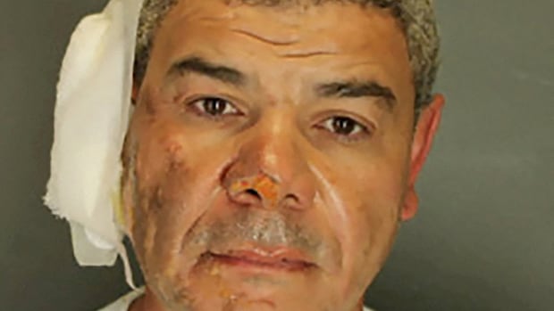 Suspect charged with hate crime in attack at pro-Israeli rally in Colorado