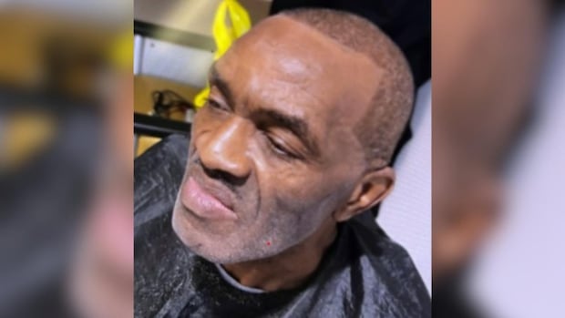 Toronto police searching for missing man last seen near Mount Dennis on Saturday | CBC News