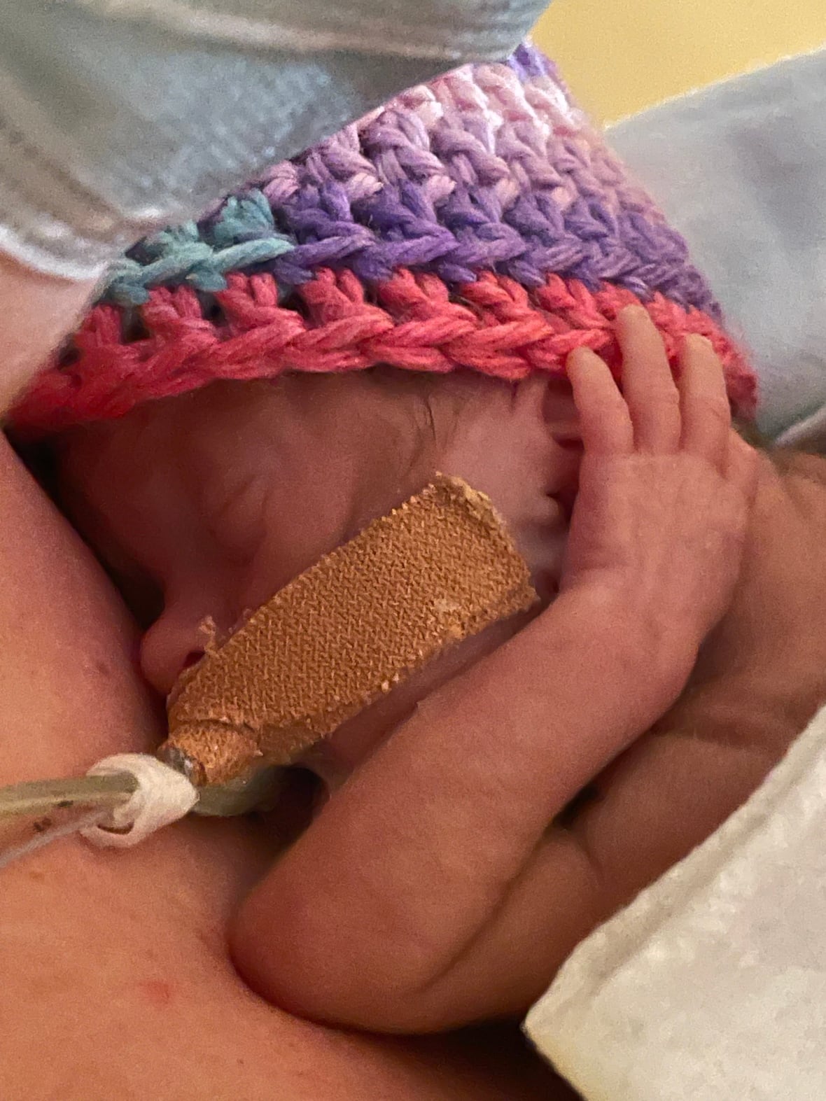 A premature baby in a knit cap holds its hand to its ear.
