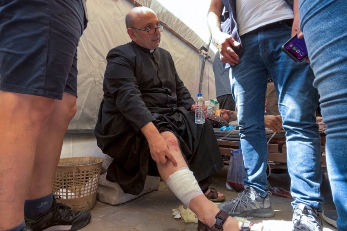 A bald, bespectacled priest points to a bandage on his leg.