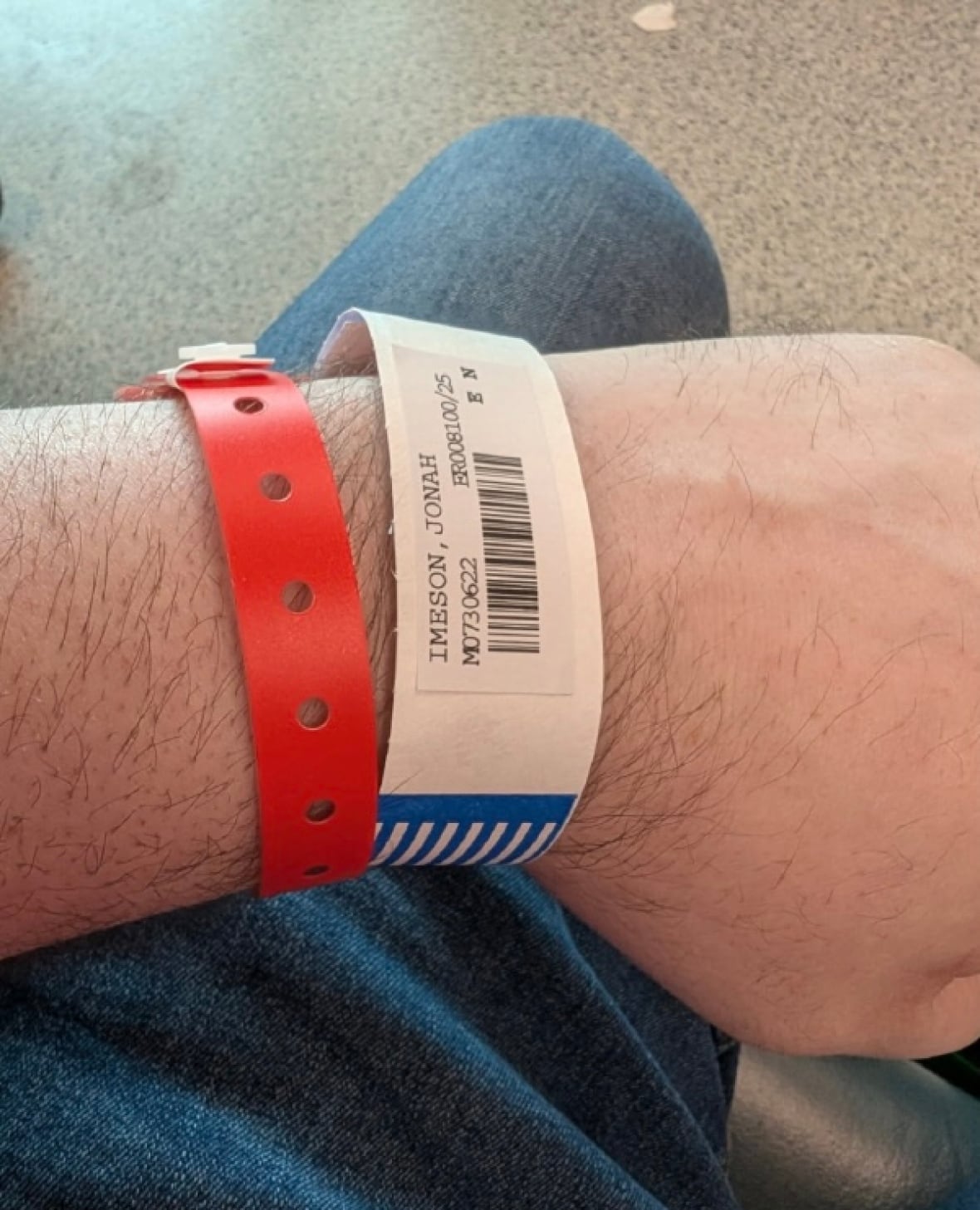 close up of man's wrist with hospital id bracelet and red plastic bracelet