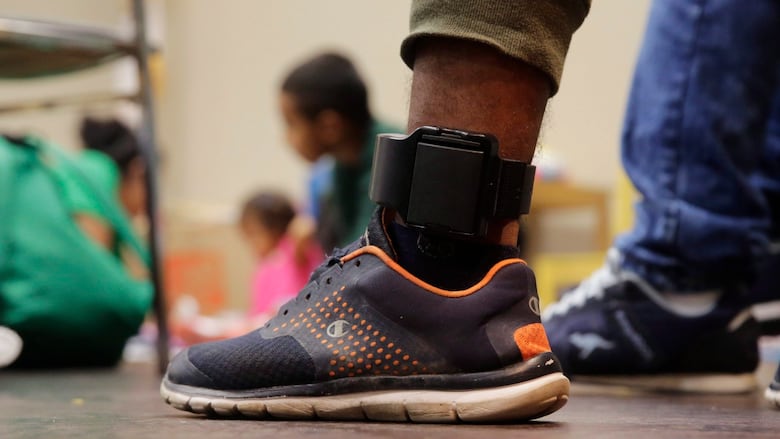 Close up of a man's ankle with an electronic monitoring bracelet on it