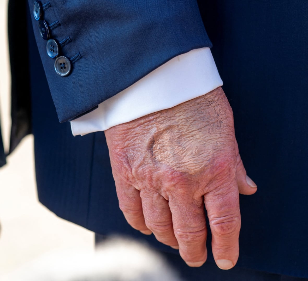 Makeup partially covers the back of the right hand of U.S. President Donald Trump.