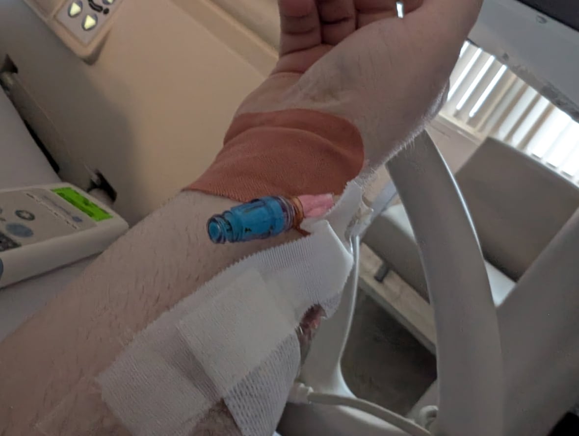 closeup shot of Imeson's wrist with IV going in