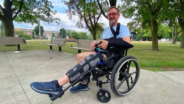 '911 let us down': He says Toronto police took over an hour to respond after he was brutally assaulted | CBC News