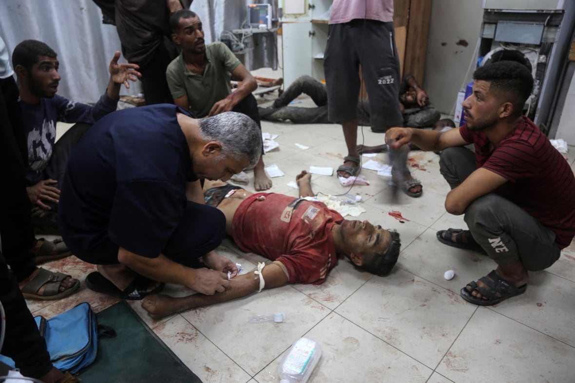 Injured people lay on the floor of a hospital as they are treated by others.