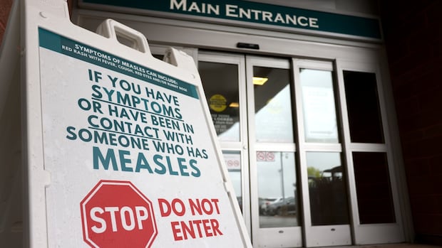 Measles exposure possible at 2 Vaughan locations, public health agency warns | CBC News