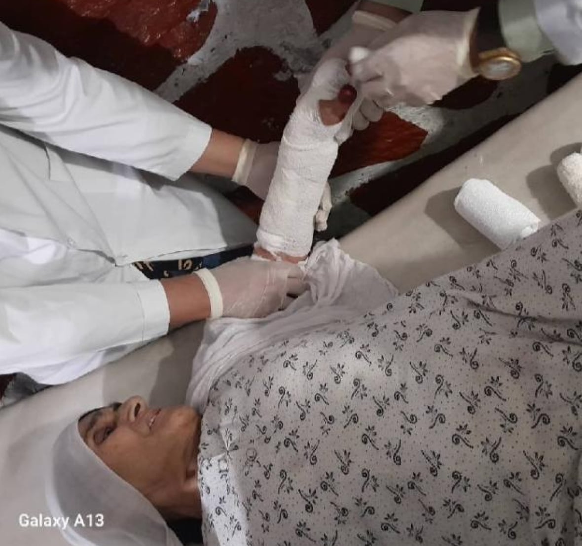 A woman on a hospital bed, in a hospital gown, has her arm, which is in a cast, looked at by a doctor.