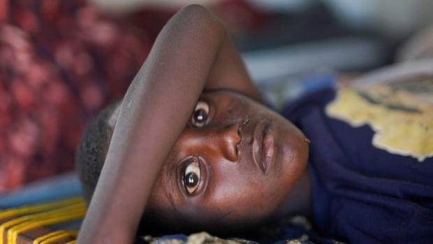 A young boy lies on his back with one arm over his forehead, looking directly into the camera. 