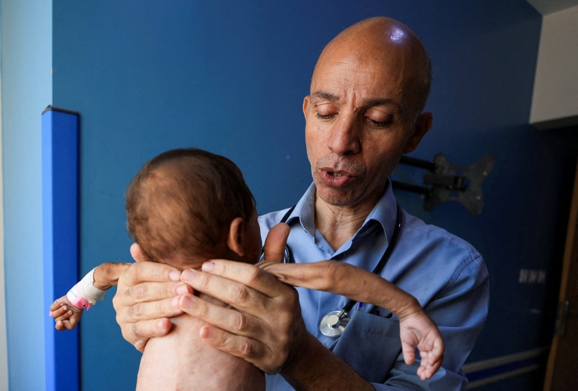 A man wearing a blue shirt and a doctor's light carrying an incredibly thin child.