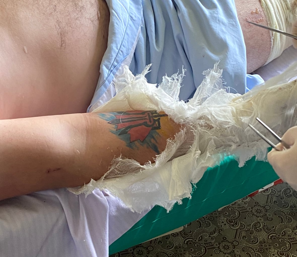 A picture of the tattoo on the right arm of the Mac Hughes taken at a hospital in Zaporizhzia on July 2, after he survived a drone one day ago 