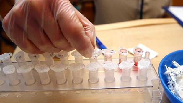 Medicine diagnostician Lars Koehler makes a blood testing during a sports performance diagnostic of triathletes at the Medicos Auf Schalke rehabilitation, fitness and wellness center on March 12, 2009 in Gelsenkirchen, Germany. 