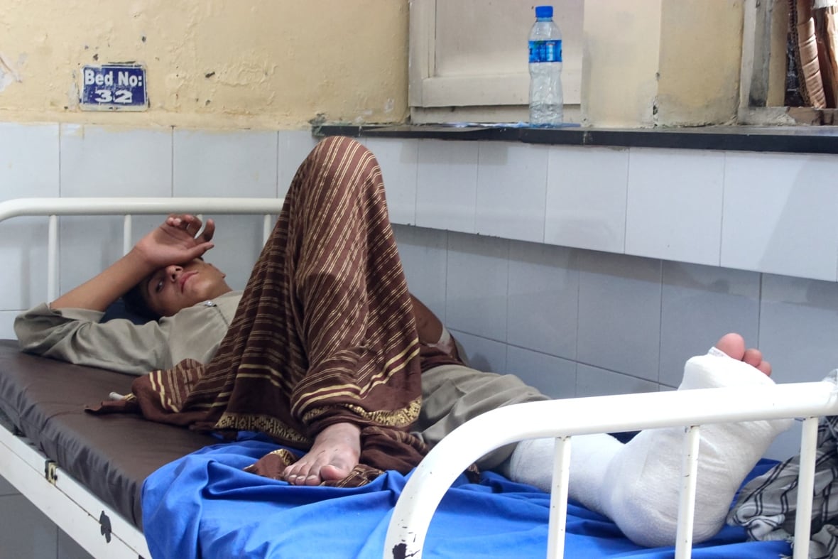 یک جوان مرد تا حدی سر خود را با دست خود می پوشاند در حالی که روی یک میز پزشکی با بازیگران روی پای چپ خود دراز کشیده است.