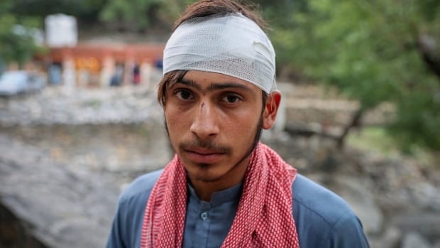 Close up of a young man dressed in blue, with a red and white scarf around his neck, with a bandage wrapped around his head.