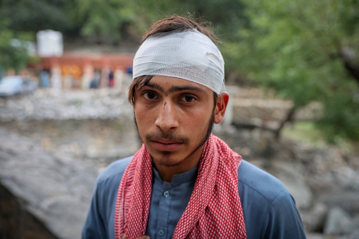 About a young man wearing a blue color, with a red and white scarf around his neck, with a bandage wrapped around his head.