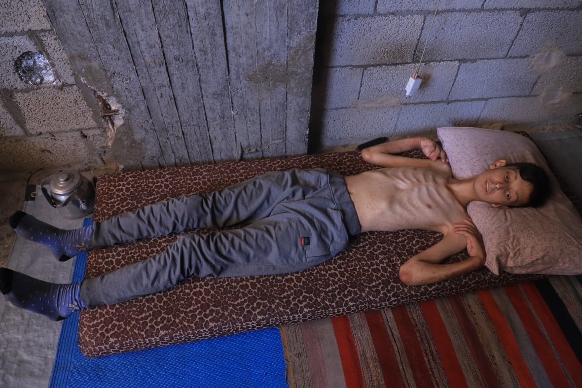 In the week before his death, Ahmed spent most of his days inside the Gaza refuge, hunger from nutrition and energy.