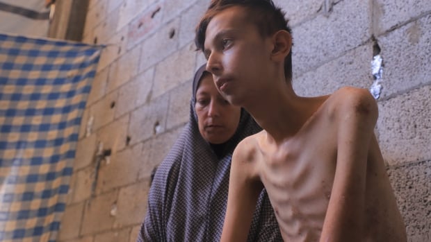 Ahmed Ali Al Batniji, 17,  sits with his mother in their makeshift shelter in Gaza City.  The teenager suffered from celiac disease which made his body intolerant to gluten.  After Israel's seige of the enclave and halt to food deliveries in March,  most of the food he relied on disappeared from markets.