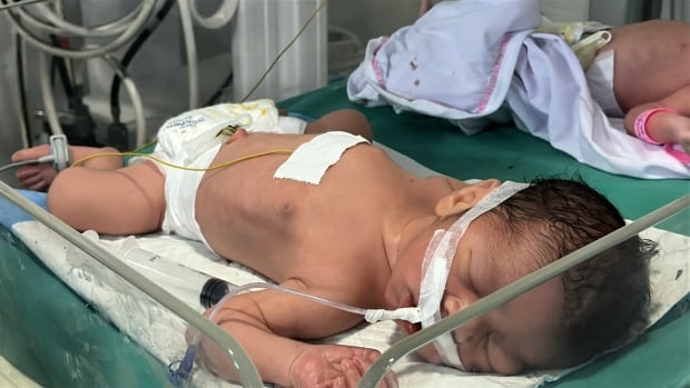 A baby lies on a hospital bed.