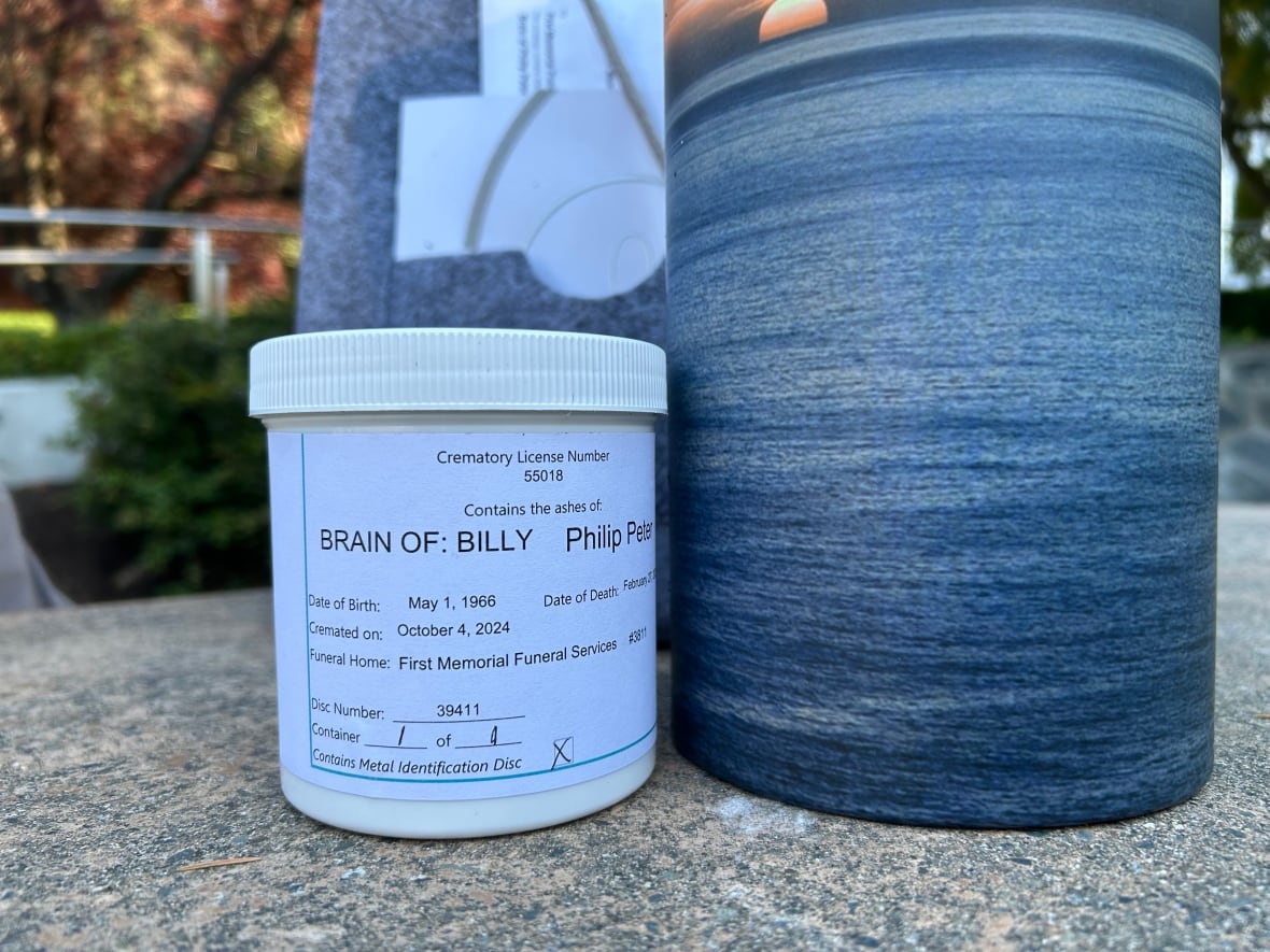 A jar that reads brain of 'Brain of: Billy, Philip Peter.'