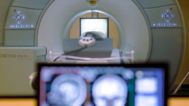 A brain-scanning MRI machine with a monitor in front showing brain images. 