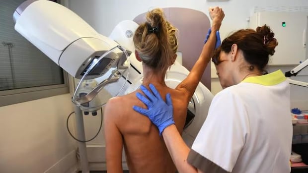 Quebec Institute Recommends Lowering Breast Cancer Screening Age to 45 Amid Rising Cases