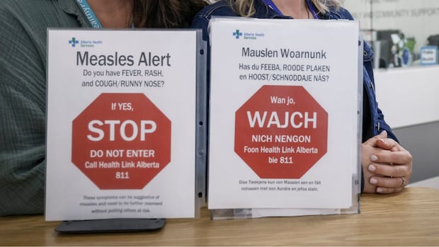 Two signs on a counter warn about measles symptoms in English and a dialect. The large red stop signs emphasize not to enter and to call Alberta Health.