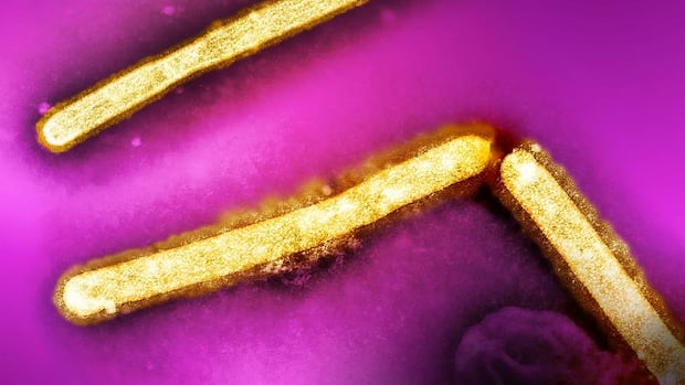 There's no question H5N1 bird flu has 'pandemic potential.' How likely is that worst-case scenario? | CBC News