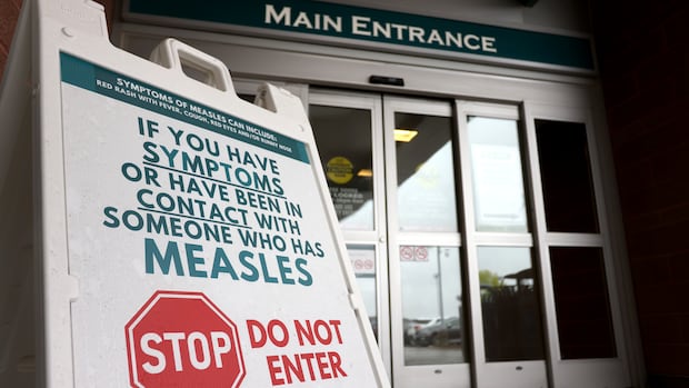Warning signage for suspected cases of measles is seen outside the main entrance of Woodstock General Hospital in Woodstock, Ont., Thursday, May 22, 2025. THE CANADIAN PRESS/Nicole Osborne Warning signage for suspected cases of measles is seen outside the main entrance of Woodstock General Hospital in Woodstock, Ont., Thursday, May 22, 2025. THE CANADIAN PRESS/Nicole Osborne
