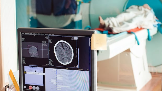 A scan of a brain on a computer screen, with a person lying on a platform in the background.