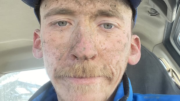 Liam Johnston was 27 years old when died at work after a trench collapsed on him in Calgary in June 2023 A close up shot of a blue eyed man with a sparse beared and mud spattered face sitting in his car