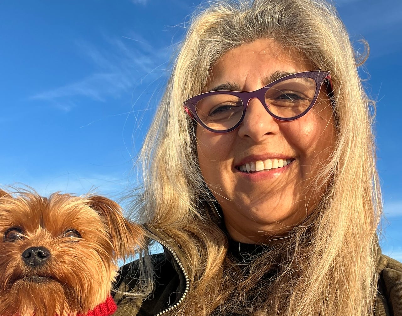 Rena Hans holds her dog.