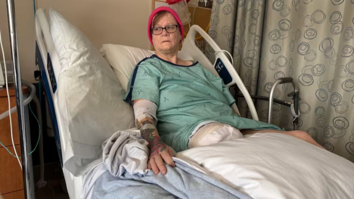 Woman's right leg amputated after waiting 8 days for bed at Winnipeg's HSC to treat open wound | CBC.ca