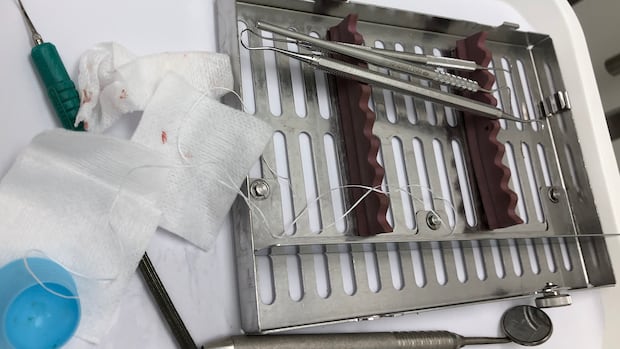 Roughly 28,000 people received care after they were given an inaccurate assessment under the national dental insurance plan. Dental instruments sit on a try inside a dental office.