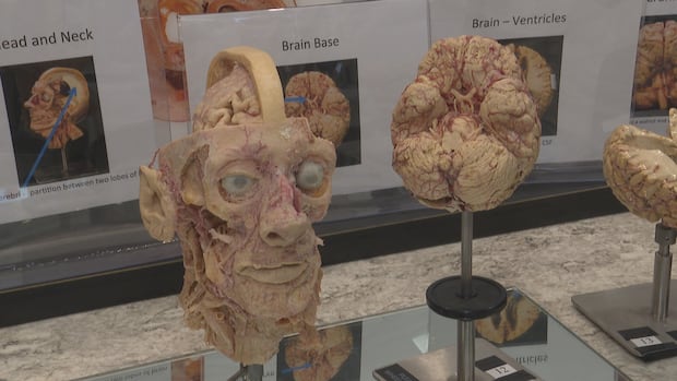 See the human body — and parts of it — like never before at an exhibit at MUN