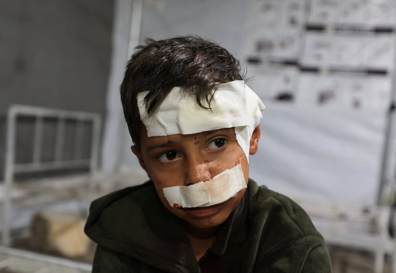 A child with a bandage around his head